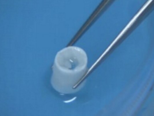 蓝光发展3D打印血管或成“虎头蛇尾”:到底FDA临床没有？