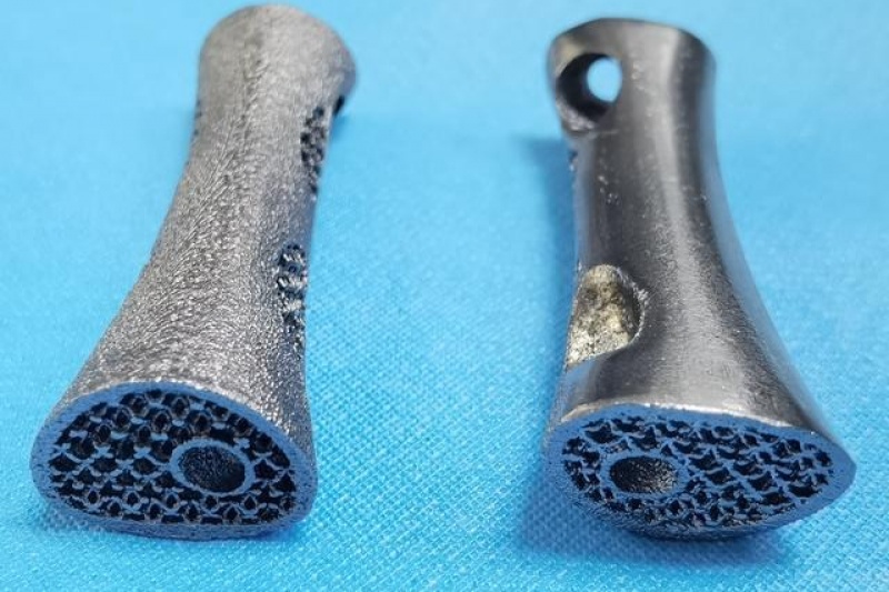世界首例3D打印钽金属人工椎体临床应用研究在西安完成