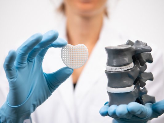 赢创推出可定制RESOMER® PrintPowder，用于植入医疗器械3D打印个性化应用